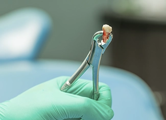 Extracción Dental